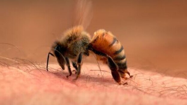 Anafilaxis. Las picaduras de avispas y de abejas causan unas cinco muertes al año en España