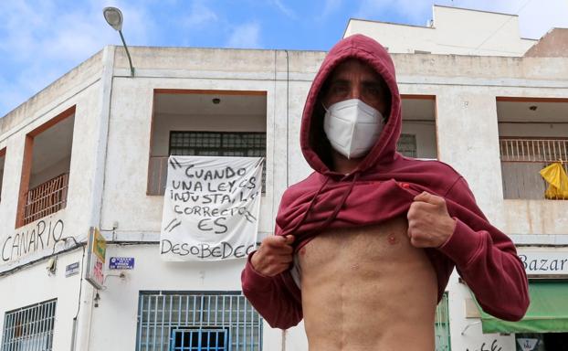 Un residente en el barrio deLas Rehoyas muestra la cicatriz de una puñalada en el pecho, al fondo, pancartas en protesta contra la inmigracion. / ALEJANDRO RAMOS